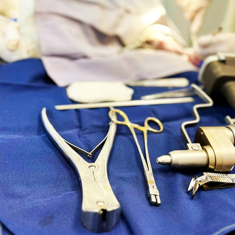 Остеосинтез с использованием пластин и спиц